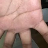 Hand1