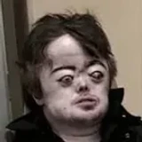BillyHvH